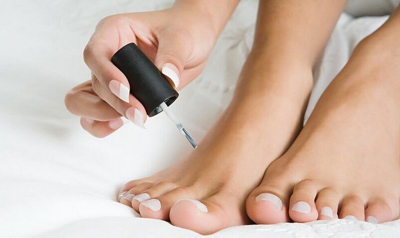 用指甲油治疗脚趾甲真菌